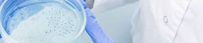 Image of cells in a Petri Dish